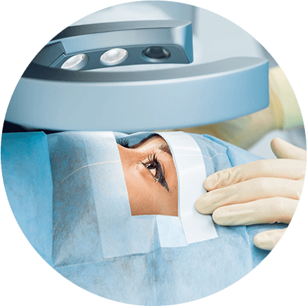 Woman getting a cataract eye surgery